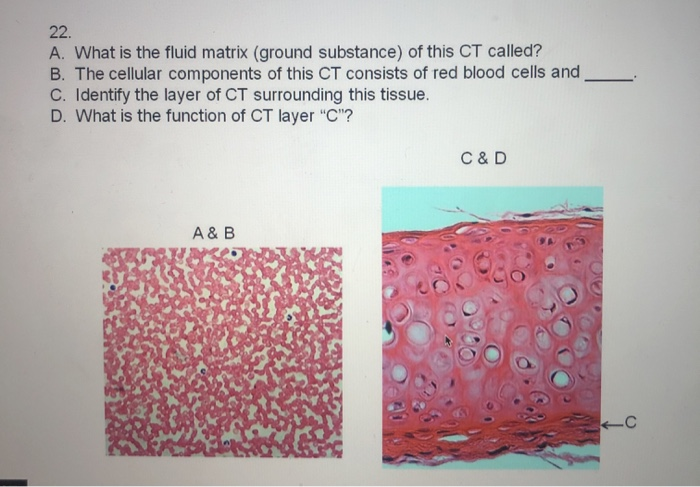 Solved A. What is the fluid matrix (ground substance) of | Chegg.com
