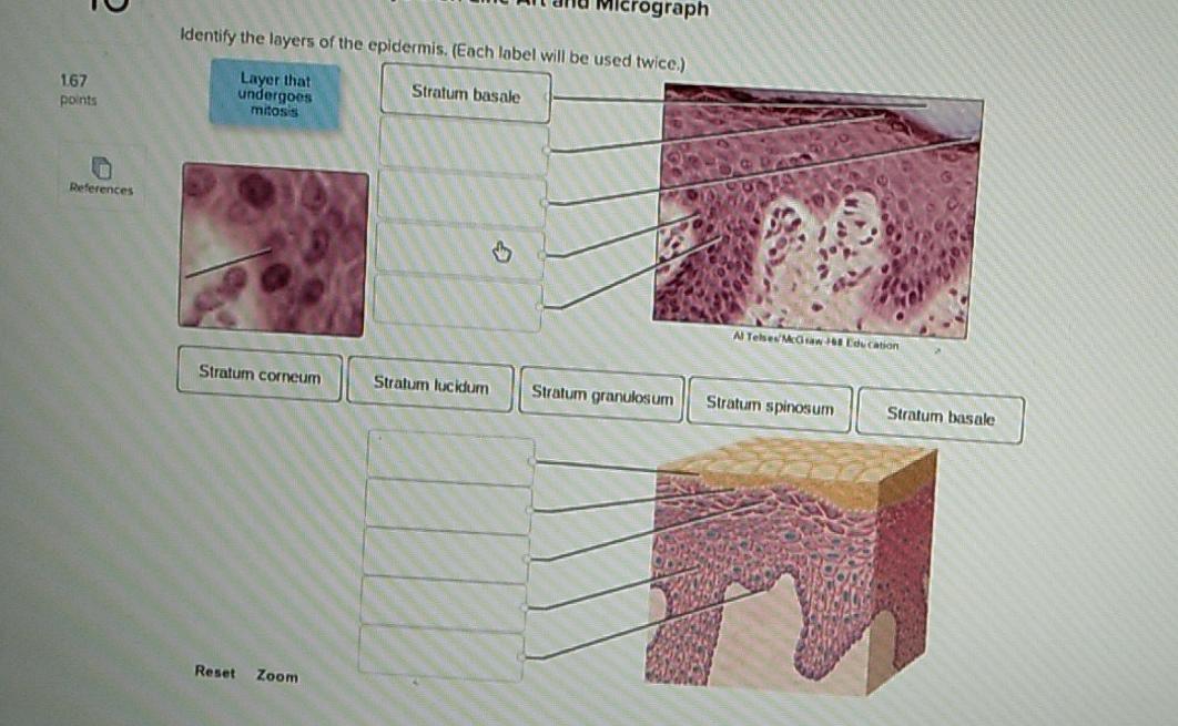 Solved Identify epidermal layers on line art and micrograph. | Chegg.com