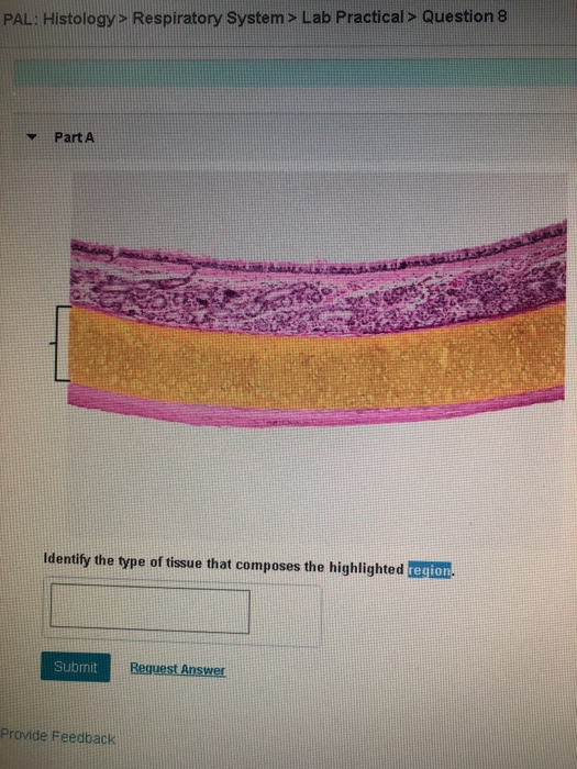 Solved PAL: Histology&gt; Respiratory System &gt; Lab Practical &gt; | Chegg.com
