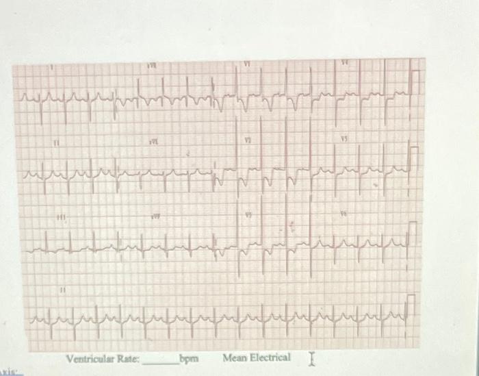 7. For each of the following 12-lead ECG's provide | Chegg.com