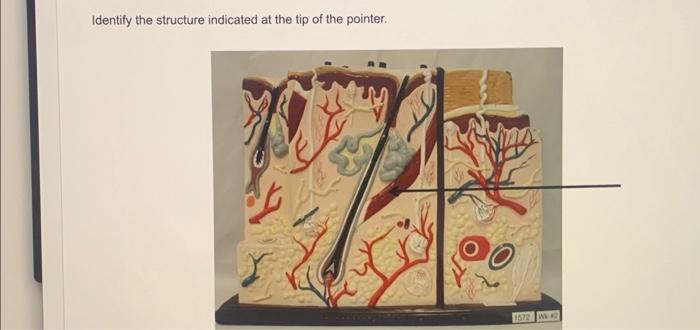 Solved Identify the structure indicated at the tip of the | Chegg.com