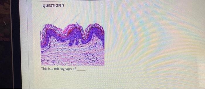 Solved QUESTION 1 This is a micrograph of Question comples | Chegg.com