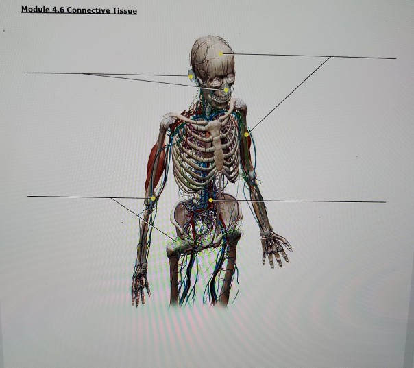 solved-module-4-6-connective-tissue-coro-chegg