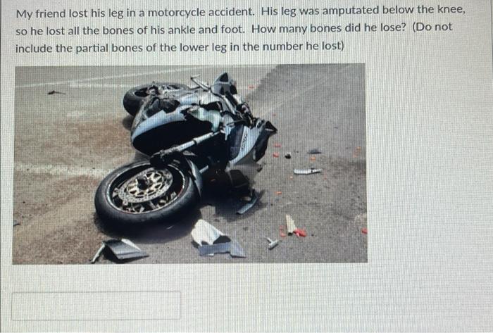 Solved My Friend Lost His Leg In A Motorcycle Accident. His | Chegg.com