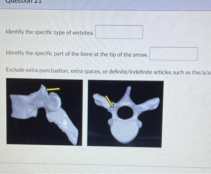 Solved Identify the specific type of vertebra. Identify the | Chegg.com