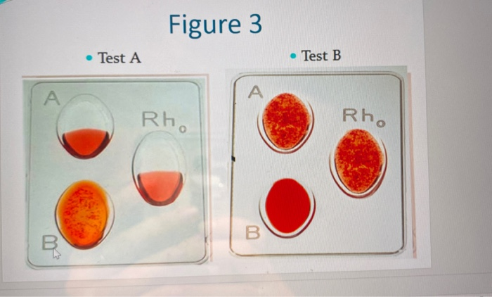 Solved Figure 3 Test A • Test B Rho Rh. | Chegg.com