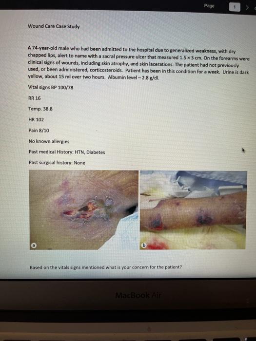 Page Wound Care Case Study A 74-year-old male who had been admitted to the hospital due to generalized weakness, with dry cha