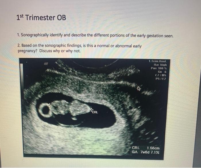 Solved 1st Trimester OB 1. Sonographically identify and | Chegg.com