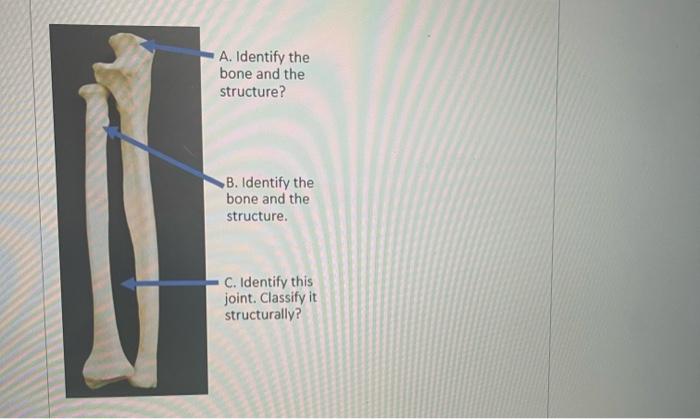 Solved A. Identify this joint What is the structural | Chegg.com