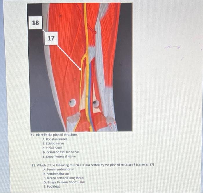 Solved 18 17 17. Identify the pinned structure A. Popliteal | Chegg.com