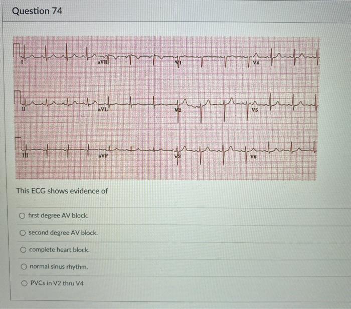 Question 74 المهم ہم السلام Avr ململ ملمعلم الميا Svl Chegg Com