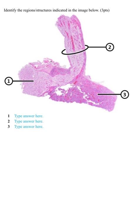 Solved Identify the regions/structures indicated in the | Chegg.com