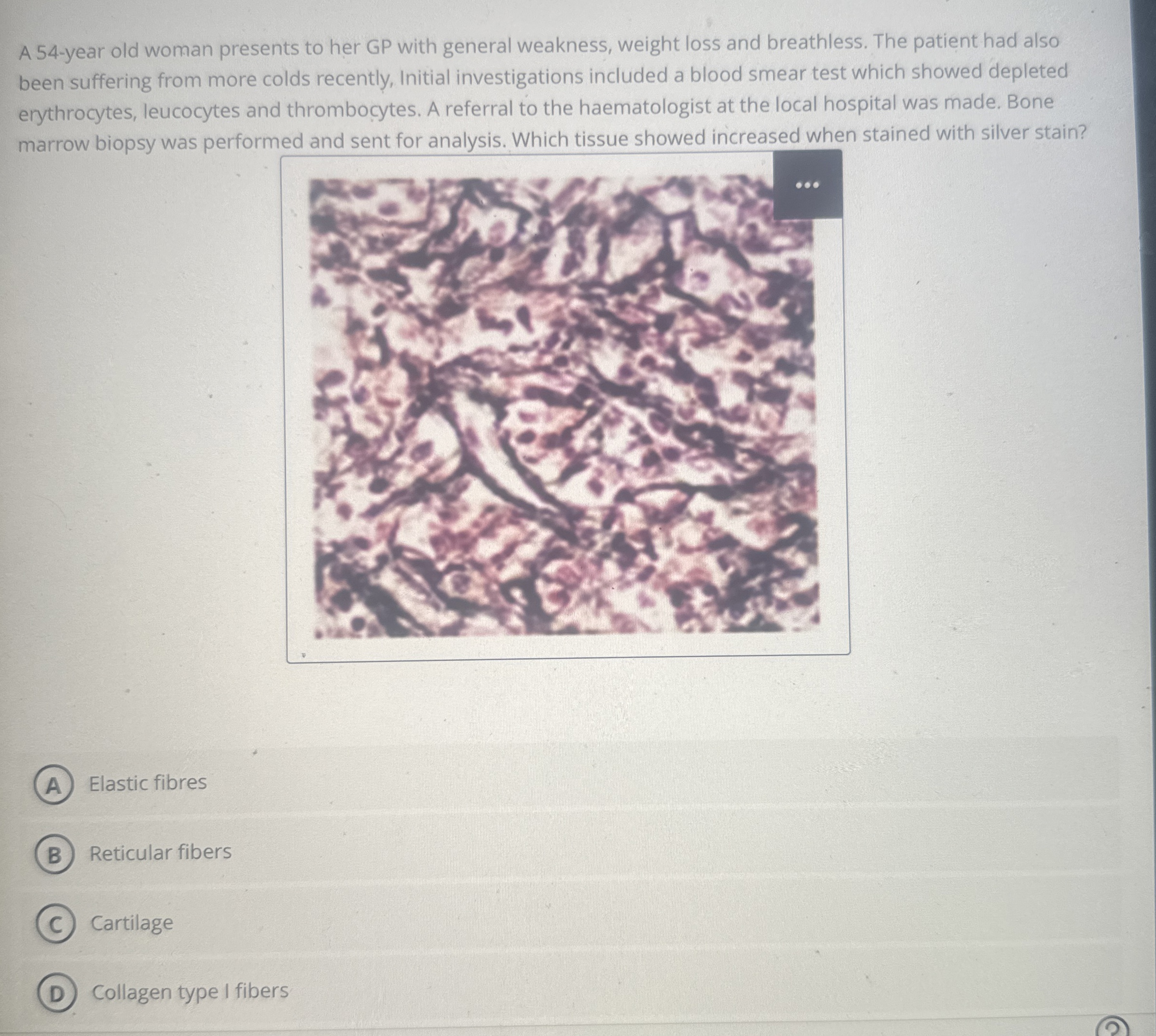 Solved A 54-year old woman presents to her GP with general | Chegg.com