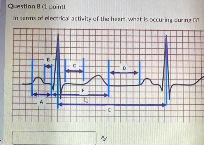 Solved Question 8 (1 point) In terms of electrical activity | Chegg.com