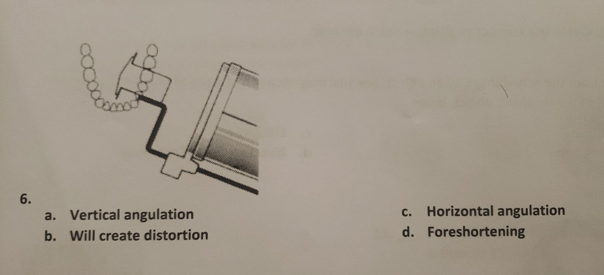 Solved 6. a. Vertical angulation c. Horizontal angulation b. | Chegg.com