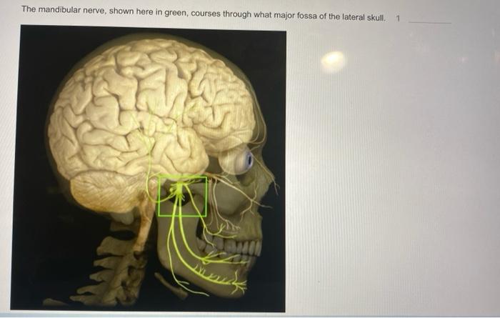 Edufit UK - The mandibular branch is the third division of the trigeminal  nerve. It passes through foramen ovale into the infratemporal fossa. 🤔 The  mandibular trunk is home to the otic