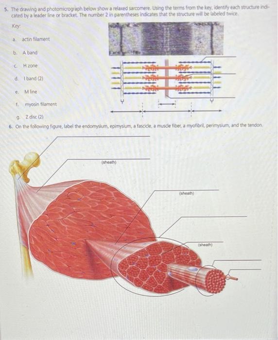 Solved 5. The drawing and photomicrograph below show a