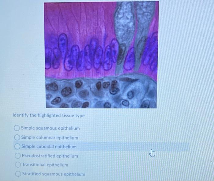 Solved Identify the highlighted tissue type 5: | Chegg.com