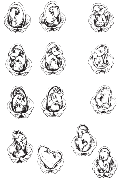 solved label each fetal presentation and position circle the chegg com solved label each fetal presentation