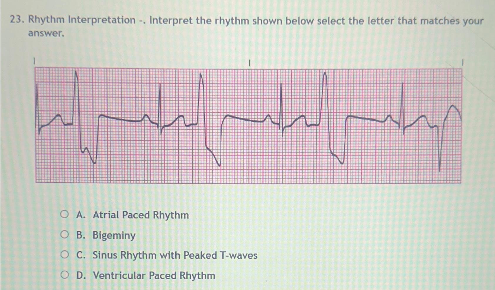 Solved Rhythm Interpretation -. ﻿Interpret the rhythm shown | Chegg.com