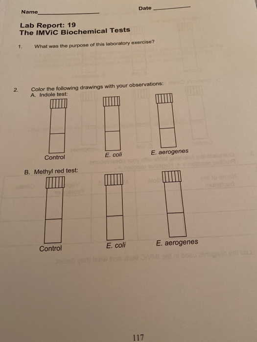 Solved Date Name Lab Report 19 The IMVIC Biochemical Tests