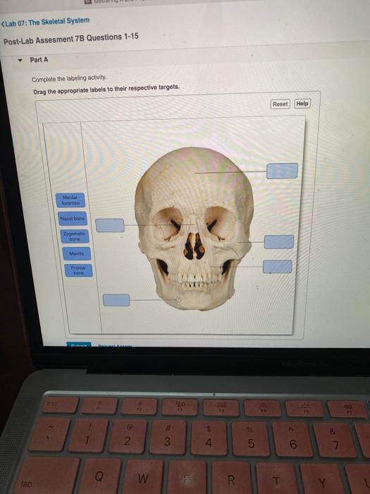 (Lab 07: The Skeletal System Post-Lab Assesment 7B ...