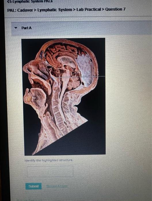 PAL: Cadaver \( > \) Lymphatic System \( > \) Lab Practical \( > \) Question 7
PartA
ldentify the fughighed strusture.