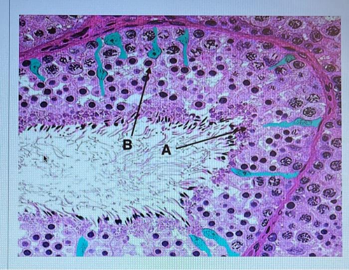 Solved Question 2 1 pts a. What are the cells identified by | Chegg.com