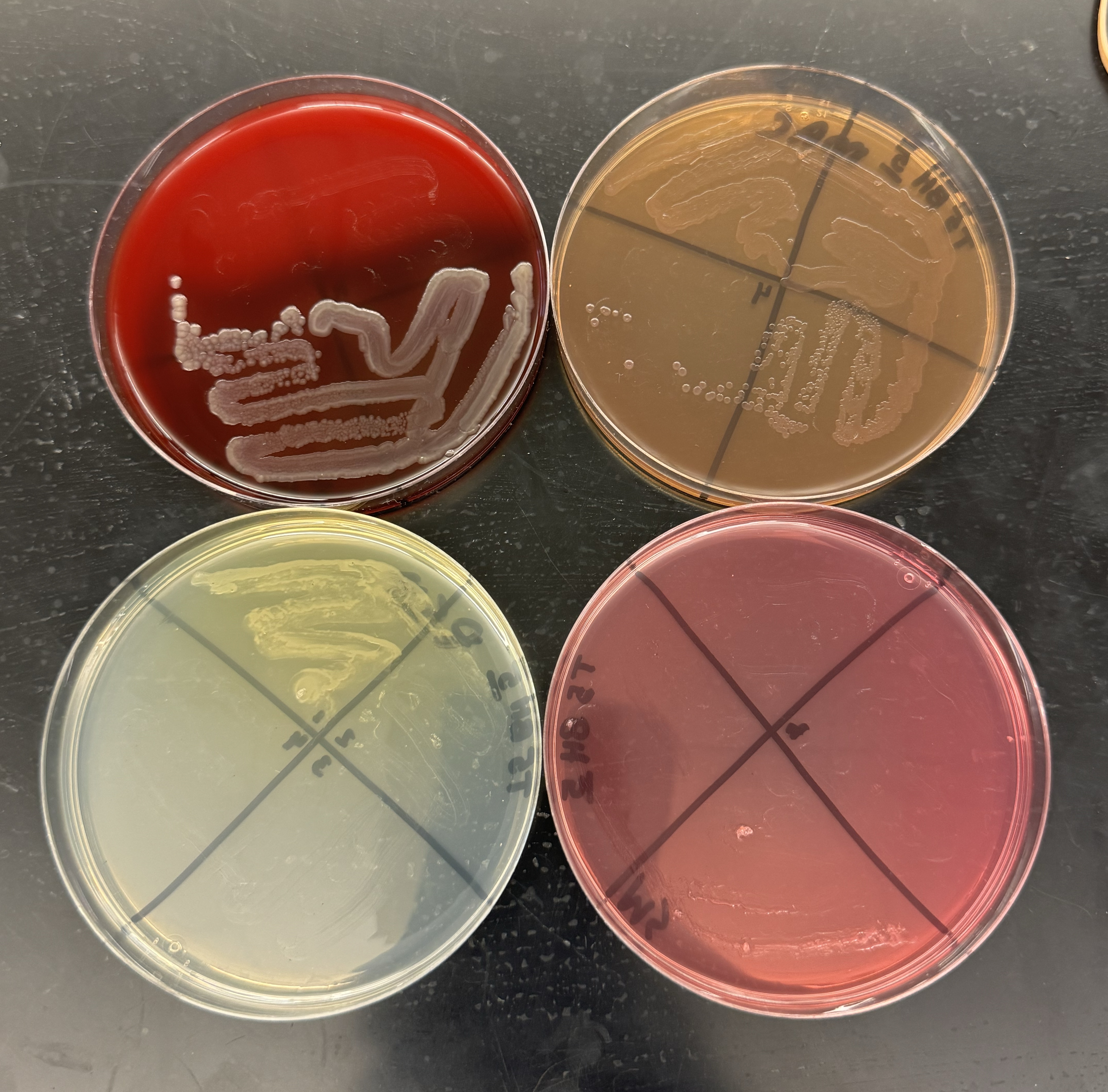 How can I figure out what kind of bacteria it is