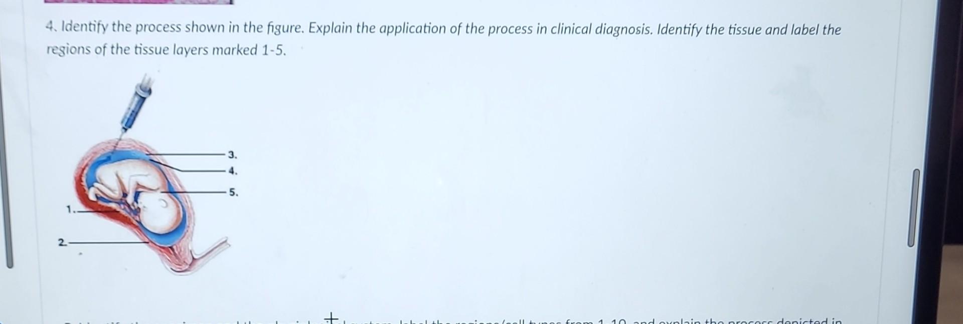 Solved 4. Identify the process shown in the figure. Explain | Chegg.com
