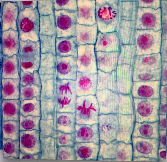 Solved Exercise C: Phases Of The Cell Cycle In An Allium 