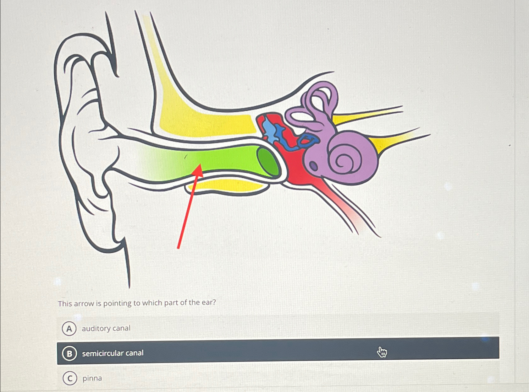 Solved This arrow is pointing to which part of the ear? | Chegg.com