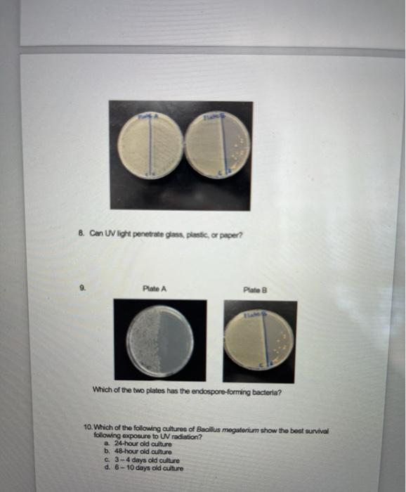 Solved Lab Assignment - Effect of Ultraviolet Light on | Chegg.com