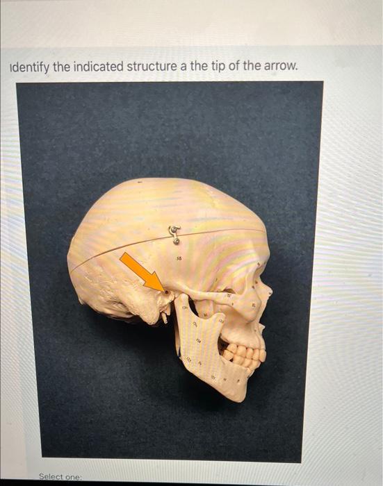 Solved Identify the indicated structure a the tip of the | Chegg.com