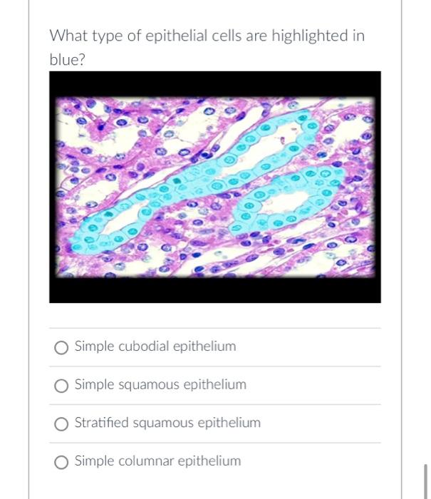 solved-what-type-of-tissue-is-highlighted-in-blue-chegg