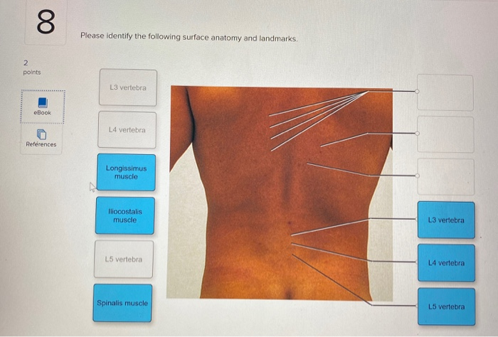 LAPAROSCOPY Origin: Greek Lapara- the soft parts of the body between the  rib margins and hips- the flank or loin  Skopein, which means to see or  view. - ppt download