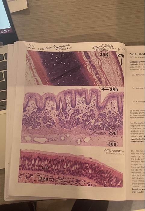 Solved Label Each Number Using Connective Tissue Epithelial Chegg Com