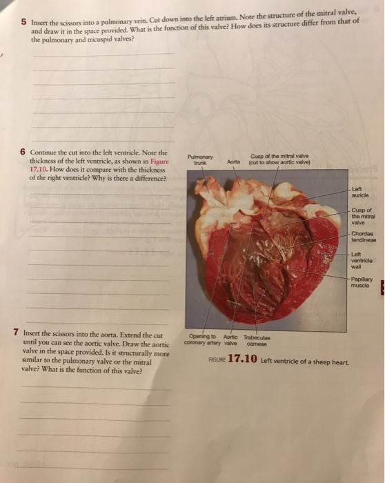 Solved Finding the coronary vessels tends to be difficult | Chegg.com