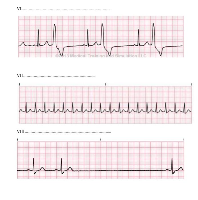 Solved 6. Identify ECG changes and specify the disease in | Chegg.com