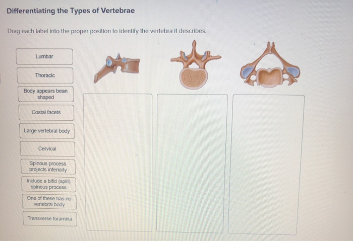 Solved Differentiating the Types of Vertebrae Drag each | Chegg.com