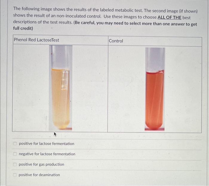 The following image shows the results of the labeled metabolic test. The second image (if shown) shows the result of an non-i