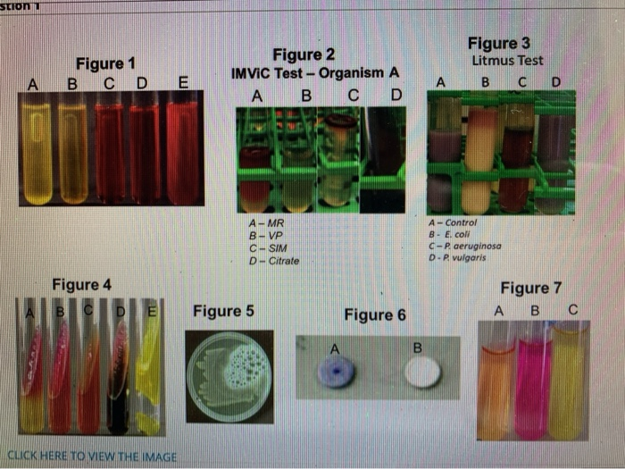 Solved STION Figure 1 B C D E Figure 2 IMVIC Test - Organism | Chegg.com