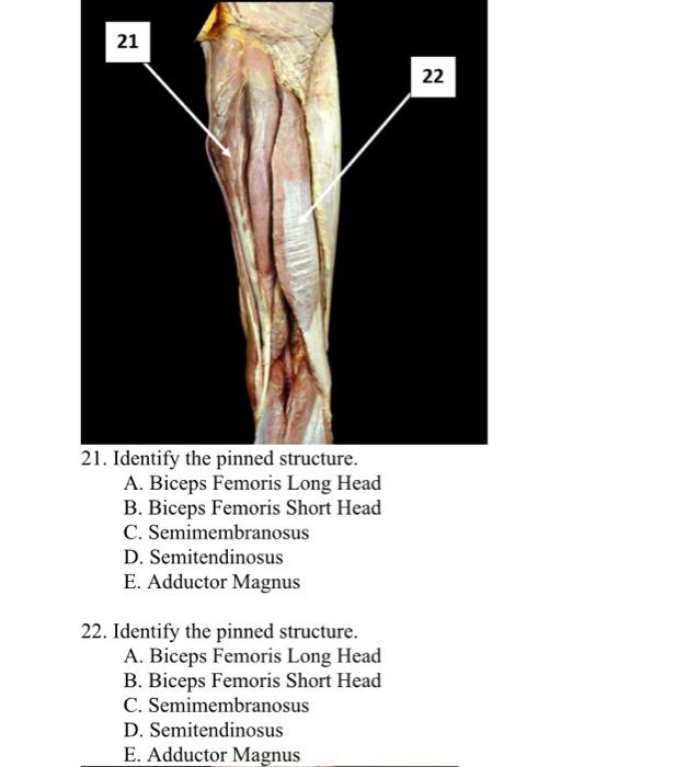 Solved 21 22 21. Identify the pinned structure. A. Biceps | Chegg.com