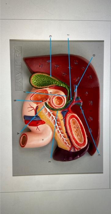 Solved Label common hepatic duct, Sphincter of Oddi, Left | Chegg.com