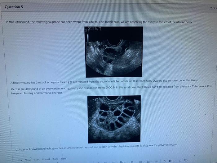 Solved 2 pts Question 4 Here is an example of an | Chegg.com