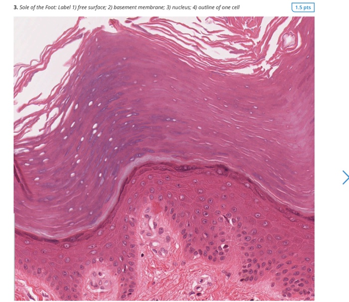 Solved a) Lining of the Esophagus. Label 1) free surface, 2) | Chegg.com