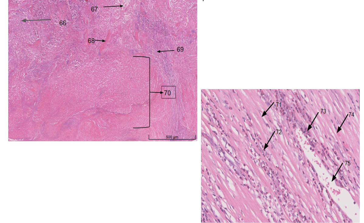 Can you please label this image and describe the | Chegg.com