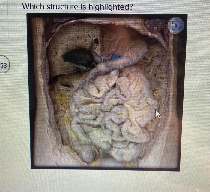 Which structure is highliahted?