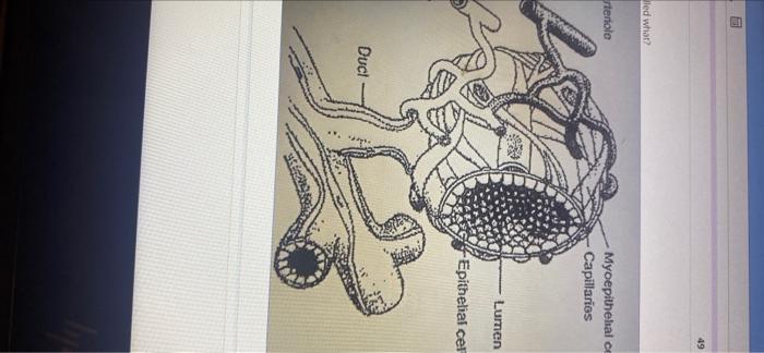 Solved What Structure Is Shown | Chegg.com