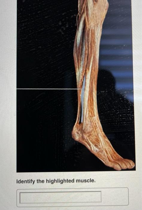 Solved The highlighted tendon inserts onto which bone? | Chegg.com